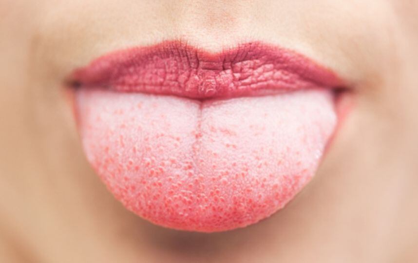 Médico explicó cómo la lengua puede revelar problemas de salud
